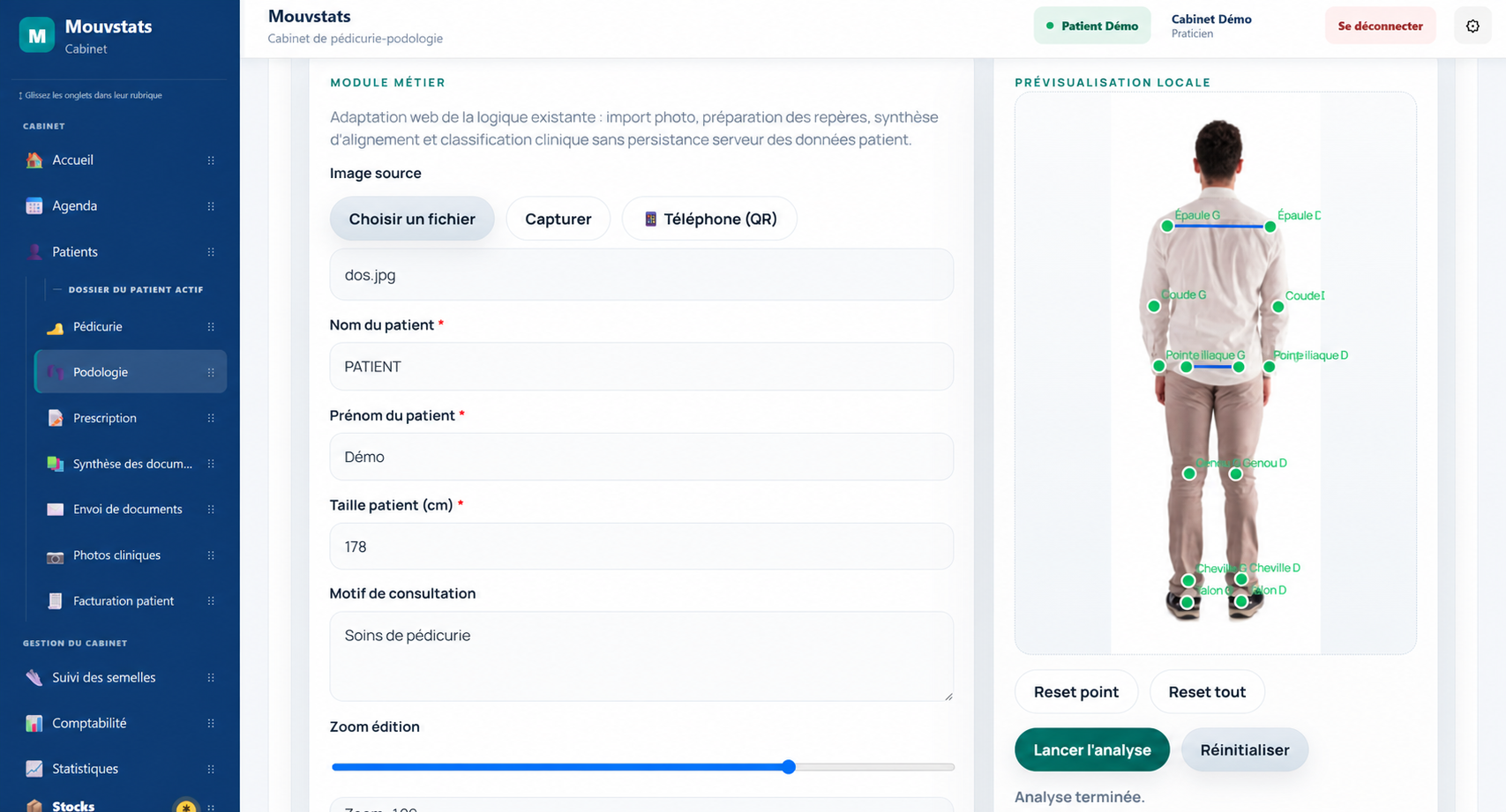 Interface réelle anonymisée de l’analyse statique du dos